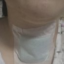 정산동물병원 | 내돈내산 암수술 병원후기 올리면 불법! 블로그 포스팅 의료법 위반 보건소 민원