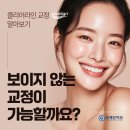 클리어(clear) 치과기공소 | 연세진치과에서 알아보는 클리어라인교정, 클리어라인치과 선택 시 확인할 점