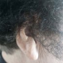 유앤아이히어링;유앤아이보청기청각센터 | 난청 해결의 첫걸음, 유앤아이히어링 보청기 상담센터 추천