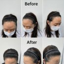 블랙샌드뷰티 | 동탄&amp;야탑 두피문신 잘하는곳 '블랙샌드 뷰티'