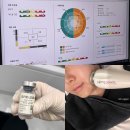 더리턴피부과의원 | 삼성역피부과 튠라이너 40kj 쥬베룩볼륨 4cc 팔자주름 오운의원 후기