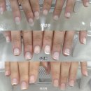 [시지 경산 네일] 대구 물어뜯는 손톱교정 &#39;미니네일&#39; (시지 경산 유일 아크릴연장 전문샾)