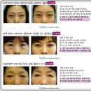 예미원피부과의원 | 예미원피부과 에서 탄력찾아왔어요~