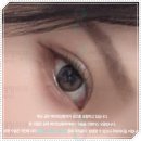 퍼스트정마취통증의학과의원 | 쌍수 재수술 비용 얼마? 40대 재수술 붓기는 오래가나요? 후기 사례 분석