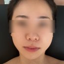 세정테라피 | [양산/중부]양산 중부동 퍼밍 윤곽 테라피 관리 후기 에스테틱샵 추천 ‘에끌라스킨’