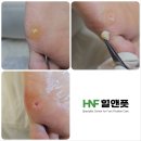 힐앤풋