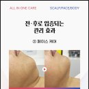 제이미스칼프