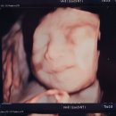 홍산부인과의원 이미지