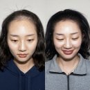 어반던트 여성두피문신｜가격 기준·후기·상담 안내