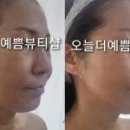 오늘 더예쁨뷰티샵