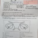 소문난소 | 엄마의 난소종양제거수술 -난소전절제술 후기2 (feat.장액성 낭성섬유종)