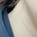 동명약초건재/동명건강원 | 왼쪽 목구멍 통증 뭔지 모르니 아찔했지만 다행