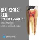 쌍문역 치과에서 충치 단계 확인하고 치료 받기 이미지