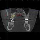 뿌리앤치과의원 이미지