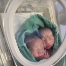 모태안여성병원 | 청주 모태안 산부인과 쌍둥이 제왕절개 5박 6일 입원후기