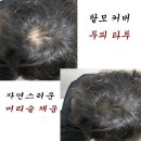 신중앙카클리닉 | 자연스러운 탈모커버 고민이라면 제주두피문신 상담 받아본 리얼 후기