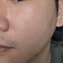 아이스웰 | 쿨래스팅 웰카밍 아이스 패드 솔직 후기 │ 햇빛에 뜨거워진 피부 진정템 [무신사 체험단]