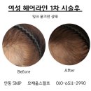 모채움스칼프