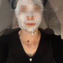 조은손성형외과의원 | 강남 청담역 ** 성형외과 표피성색소, 검버섯, 흑자, 잡티제거 리팟 레이저 후기 1(내돈내산)