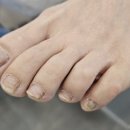 이천문제성발전문#라파엘 이미지