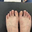 앙쏘네일 이미지