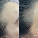 이미지헤어라인 이미지