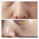주다코 홈스테틱 mts앰플 인체줄기세포 배양액 화장품 달링태그 꿀광 에센스 DSC