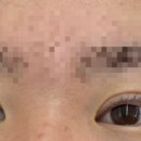 봉자속눈썹 이미지