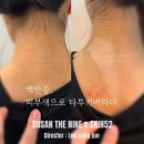 6055 | 백반증타투 커버 부산 최다성공사례보유(후기인터뷰O)