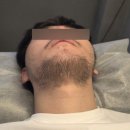 제이특공대 | 부산 남자수염왁싱 가격 제이프린 광안리왁싱 후기