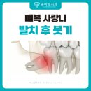 문산우리들치과의원 | 문산당동치과 매복 사랑니 발치 후 붓기, 언제까지 가고 어떻게 관리할까?