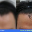 닥터공헤어라인의원 이미지