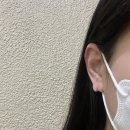 미네뜨성형외과의원 | [리뷰] 찢어진 귓볼, 이수열 수술 과정 및 후기 / 강남 성형외과의원 추천, 이수열 수술 전문 병원