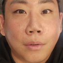 리엔장의원 | 리엔장의원(목동점)리프테라 풀페이스 6천샷 후기