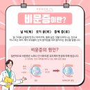 바른눈안과의원 이미지