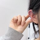 페이스라인성형외과의원 | 강남역 지방분해주사&amp;튠페이스&lt;플레저 성형외과&gt; 후기