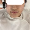 헤르메스 스킨케어 | [답십리 피부관리샵 후기] 내돈내산 여드름 관리 후기 1 - 헤르메스 스킨케어