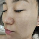 뷰티팜 | 파주 운정 피부관리샵 H.뷰티리움에서 받은 팜올로지 문제성 피부 부스터 &amp; MTS 관리 후기