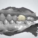 더디자인치과기공소 이미지
