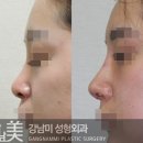 강남미의원 이미지