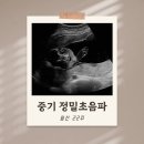 11620-전0-22-2 | [임신 22주 0일] 봄빛병원 정밀초음파 얼굴, 정밀초음파 시기, 첫 태동 느끼는 시기