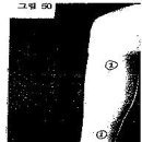 18. 생리통(生理痛), 갱년기장해(更年期障害) 이미지