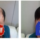 에이모가발 이미지