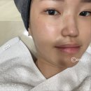 다이온약국 | 신논현역 피부과 토르 리프팅 받고옴