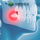 맑은신경과의원 | 당진 매복사랑니발치,'신경 손상'이 걱정되시나요?
