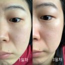 평동산단외로 | 한 포로 속광까지 챙겼다? 닥터디엣 글루타치온 10X 경험담