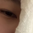 독수리눈안과의원 네이버블로그