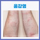 처리경로당 | 🧼 공주 옴진드기 퇴치 후기 – 주간보호센터·경로당 감염 확진 후 2차 집중 방역까지 완벽 완료! [미소...