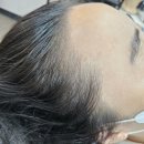 김헤어라인 이미지