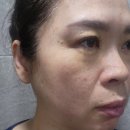 일상에서 낭독으로 만나는 행복한 시간 | 네오필 세럼 6주 사용 후기 + 1월 특별 혜택 안내